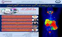 زمان برگزاری سمینار جدیدترین یافته ها در رویکرد تشخیصی با PET Scan در کلینیکال آنکولوژی اعلام شد